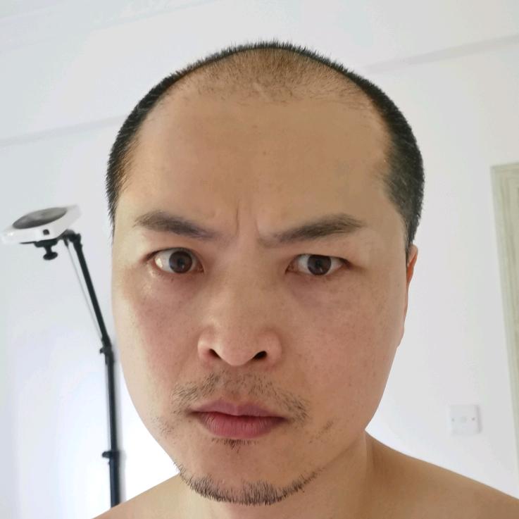 楚哥.脱发自救