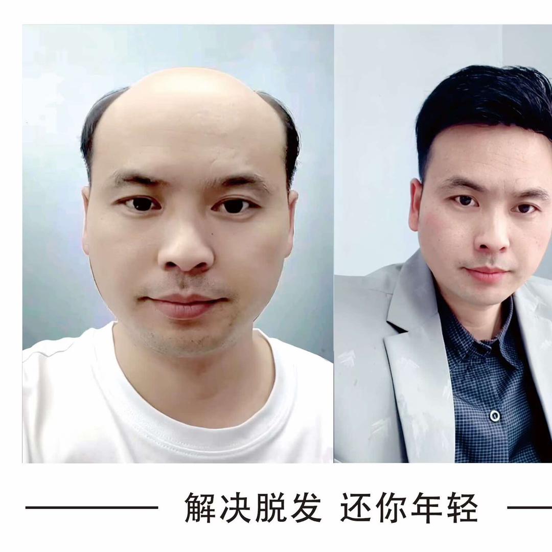 社慕颜·灵轻美业（假发定制）