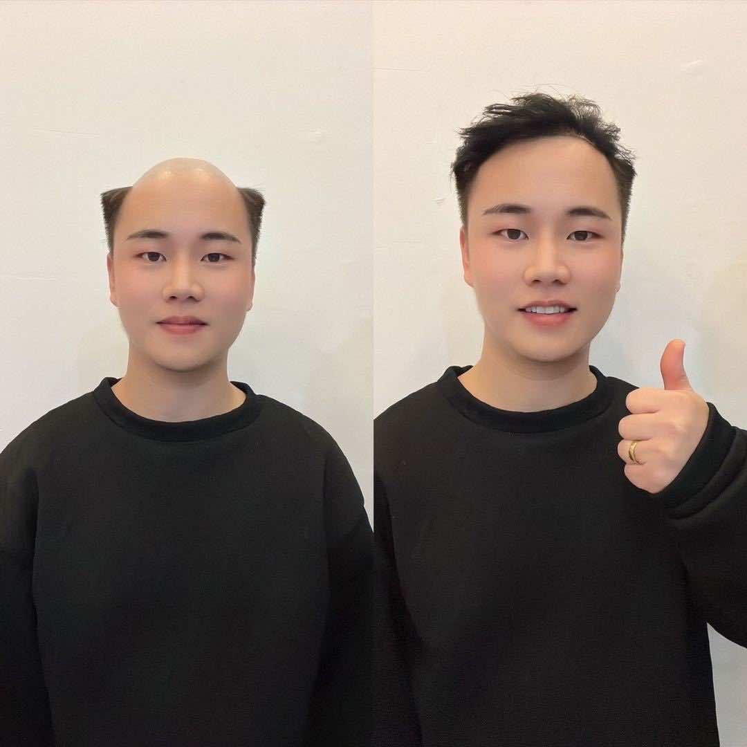 邯郸新宇接发假发收长发宁玺