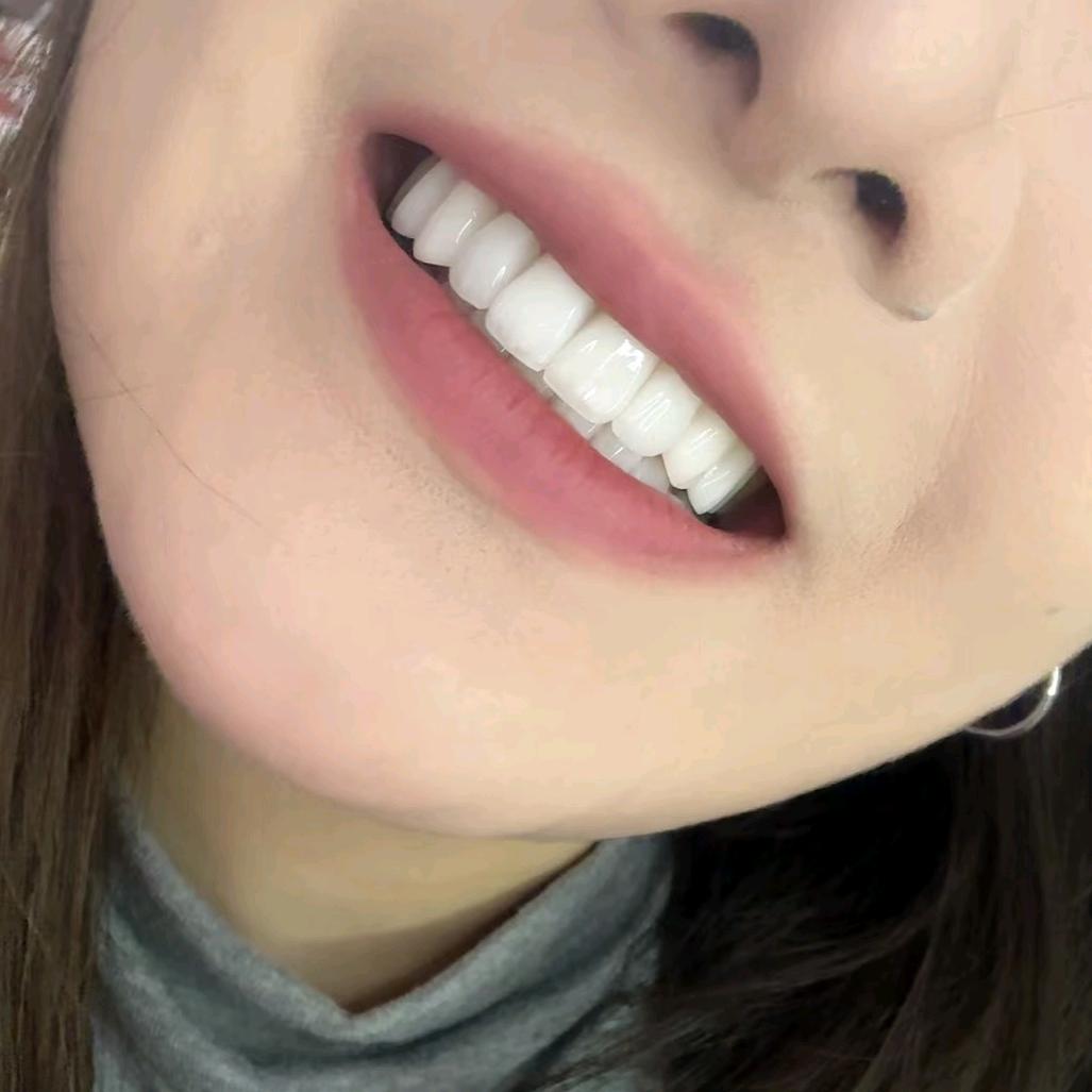 白城贝之牙