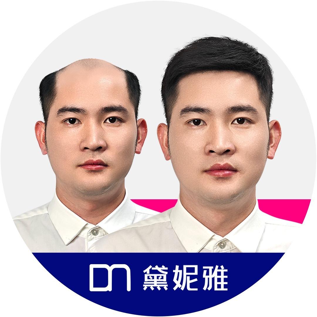 黛妮雅男士假发定制（温州总部）
