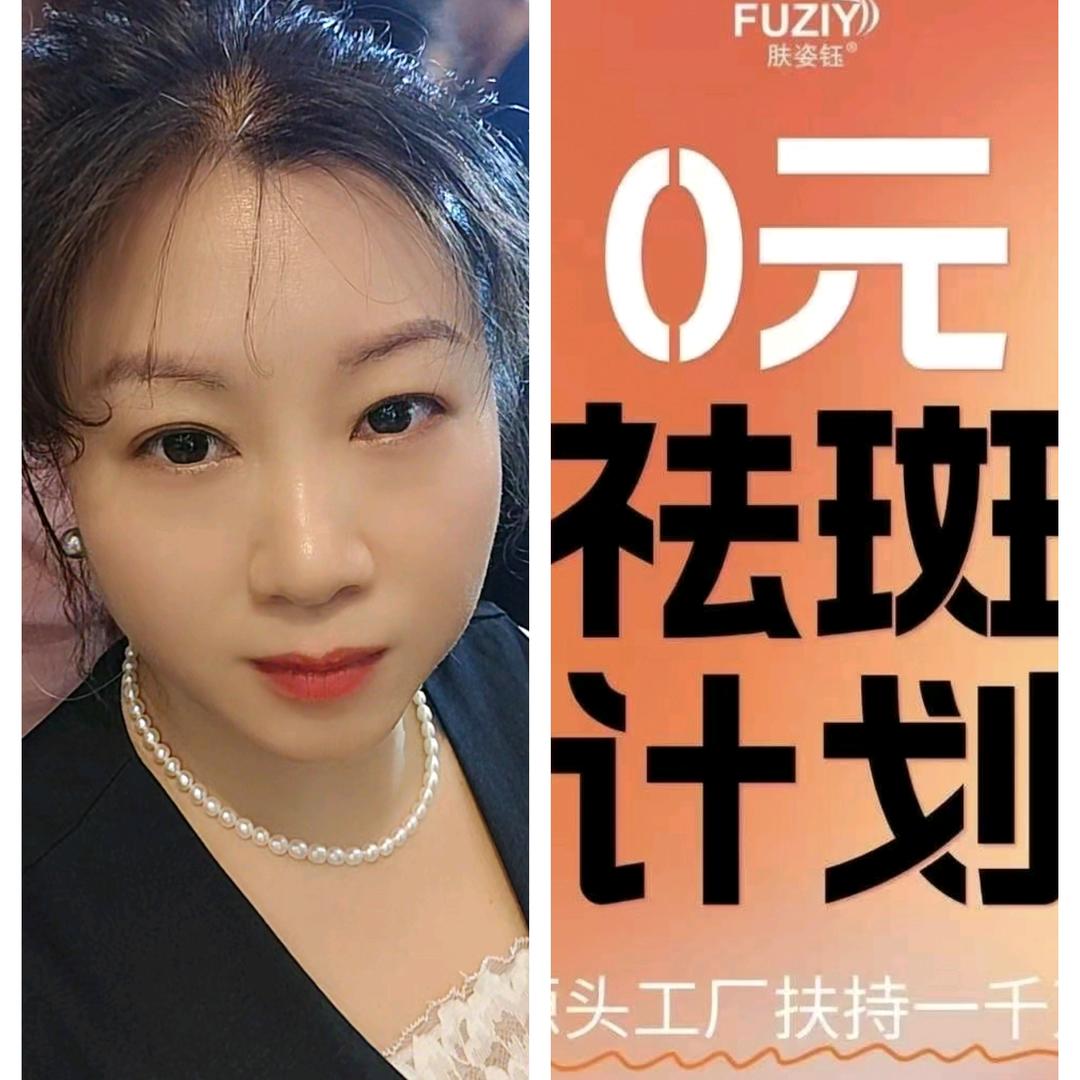 西峡源头厂家0元去斑