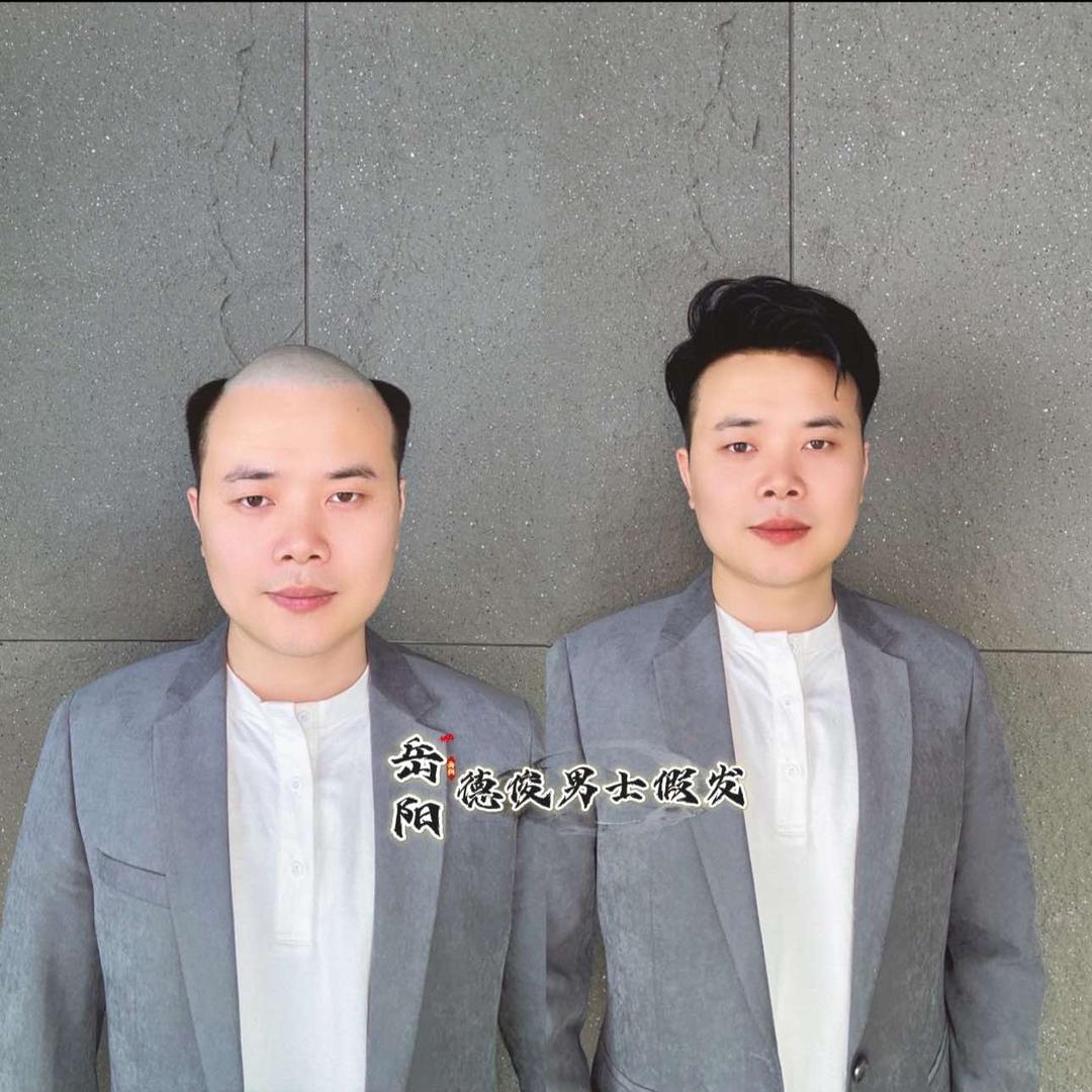 岳阳德俊男士假发官方号