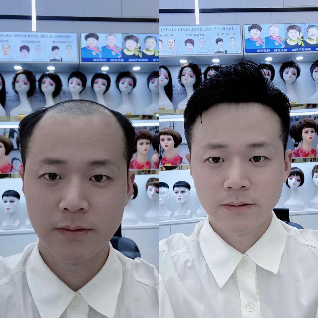 长寿区假发定制小刘