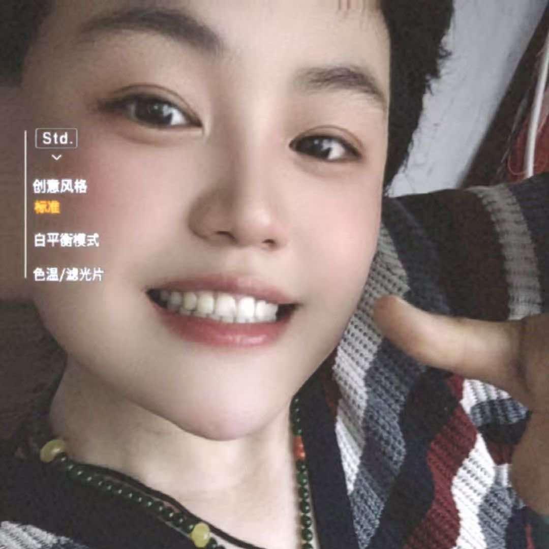 白丽丽生鲜牛羊肉批发