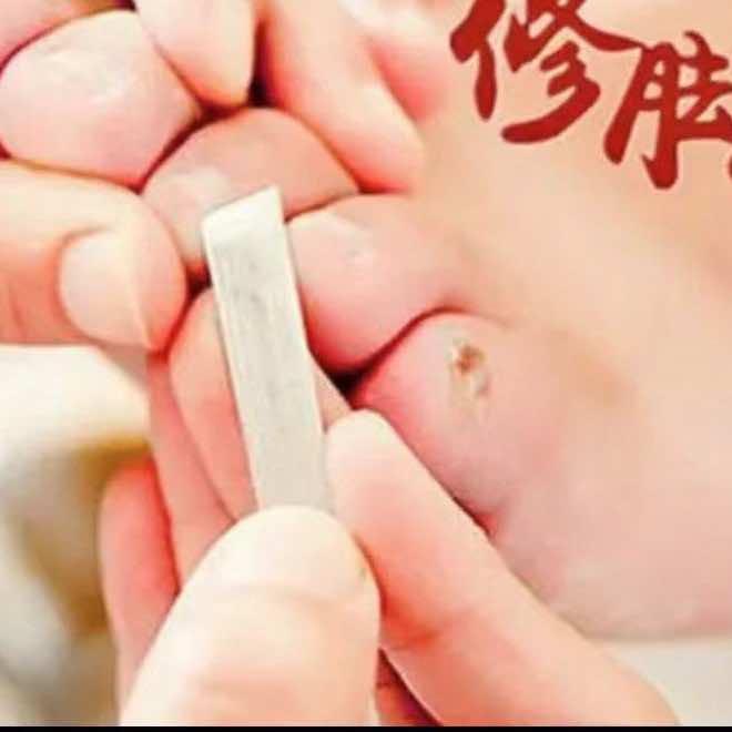 陕西专业修脚（附属医院店）