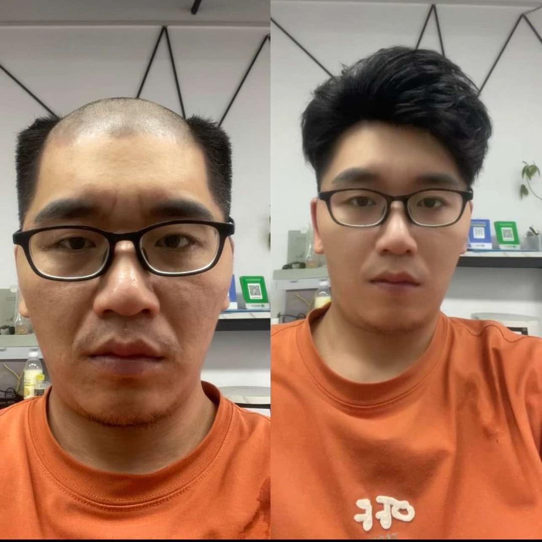 维依美发录比假发定制(春江里店)官方号