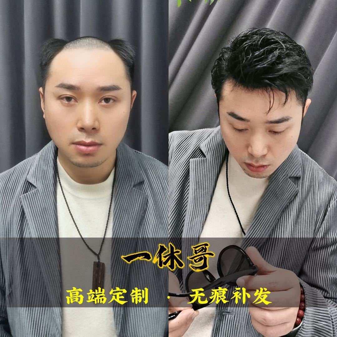 杭州一休哥假发补发