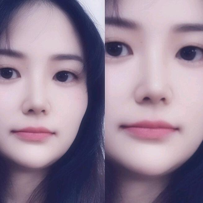 轻颜家居皮肤管理