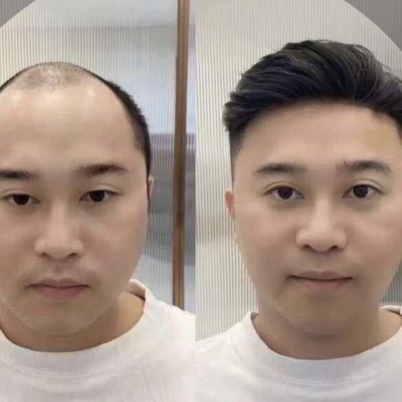 中山男士假发（超哥）