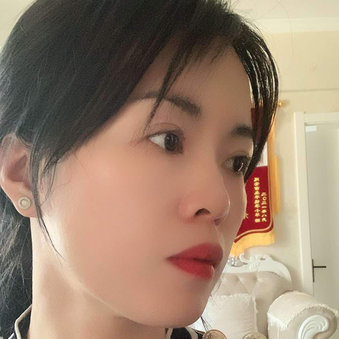 激素脸一月包治