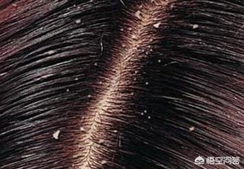 中国最高的人图片_中国最高最高的人