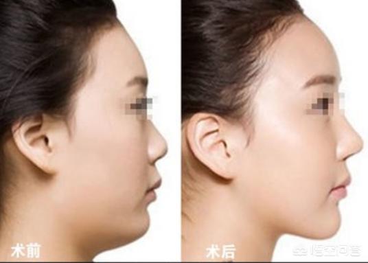 1e07400072f6cfb50b085