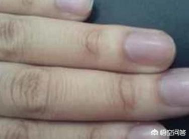 美瞳取不下来怎么办(图2)