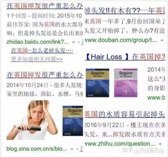 女人掉头发是什么原因(图1)