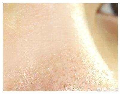 肌肤毛孔粗大怎么保养(图12)