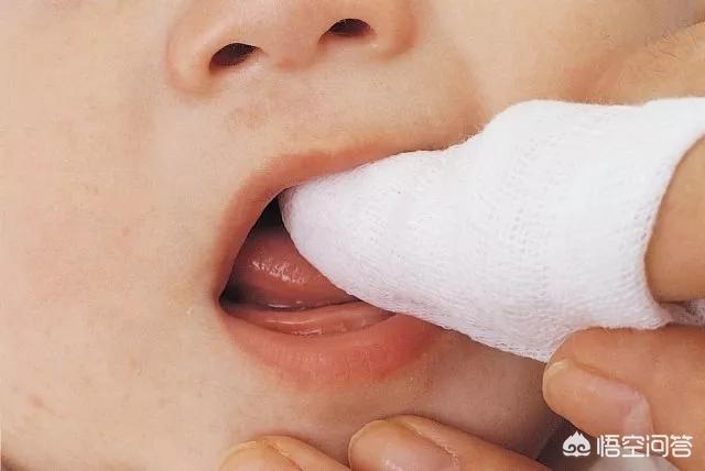 小孩几个月开始长牙？宝宝长牙的时候需要注意什么,第3张