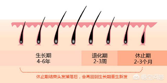 碎发多怎么扎(碎发多怎么扎头发图)