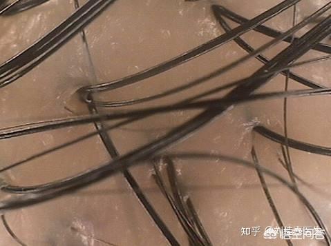 女人掉头发是什么原因(图2)