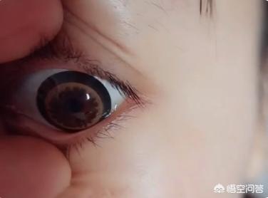 美瞳取不下来怎么办(图3)