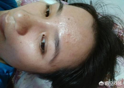 头发出油厉害怎么调理(图3)