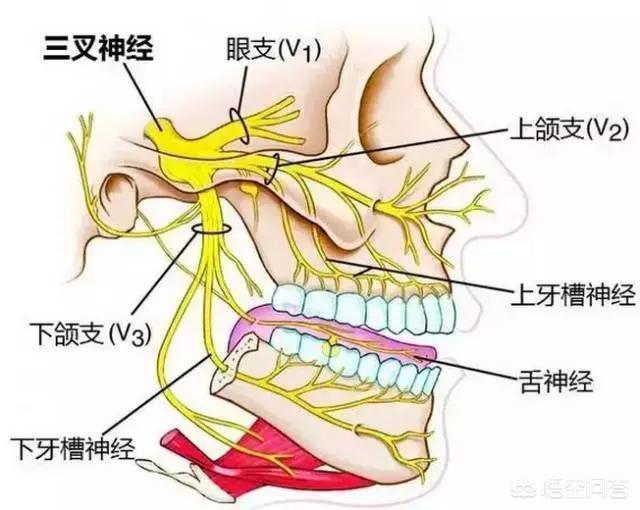 三叉神经痛怎么治疗最好(图1)