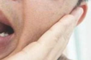 12岁男孩下巴笑脱位
