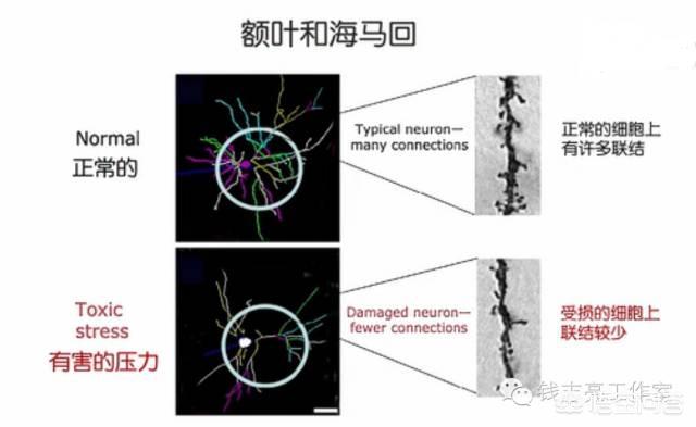 如何看待幼儿园小学化