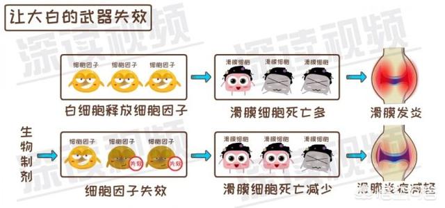 内风湿关节炎怎么调理(图15)