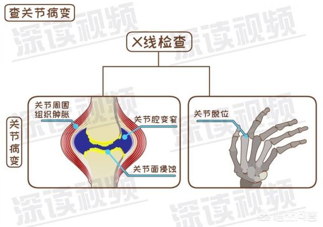 内风湿关节炎怎么调理(图10)
