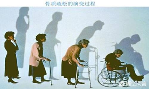 成年女性缺钙吃什么钙片最好(图11)