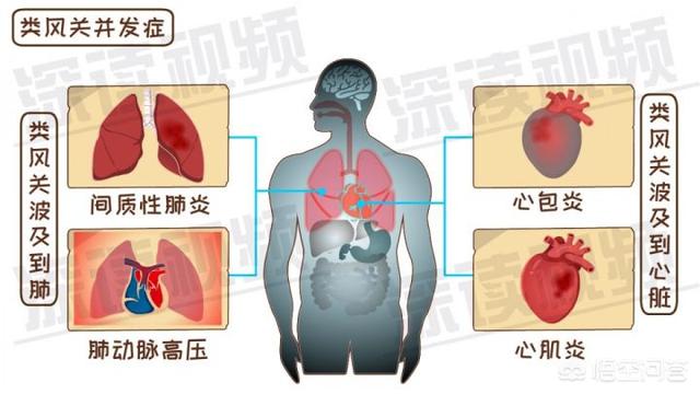 内风湿关节炎怎么调理(图6)