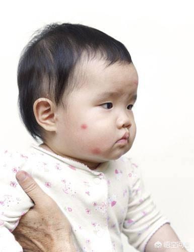 婴儿过敏怎么办（三个月婴儿过敏了如何处理）