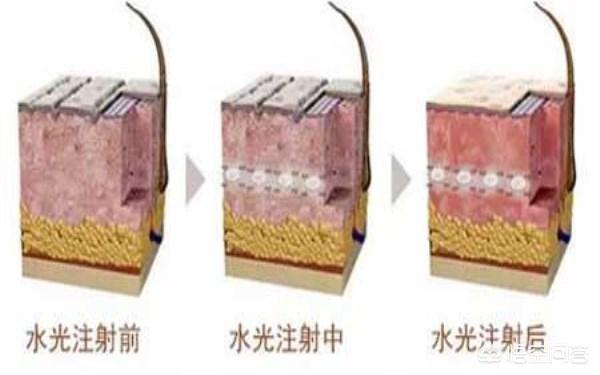 女人打水光针和不打的区别(图1)