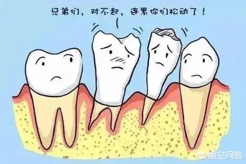 牙周炎怎么治疗最有效(图4)