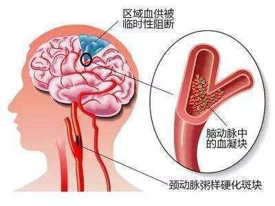经常头晕是什么原因(图1)