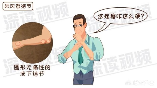 内风湿关节炎怎么调理(图4)