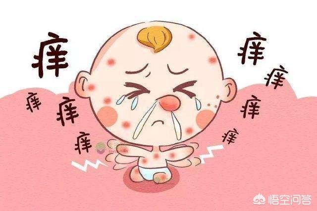 湿疹怎么保养不复发(图1)
