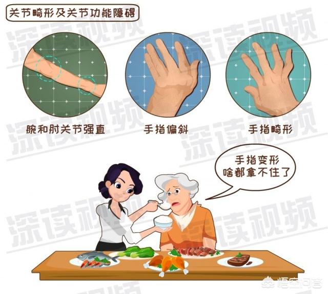 内风湿关节炎怎么调理(图5)