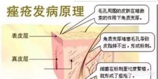 毛囊炎怎么引起的原因(图1)