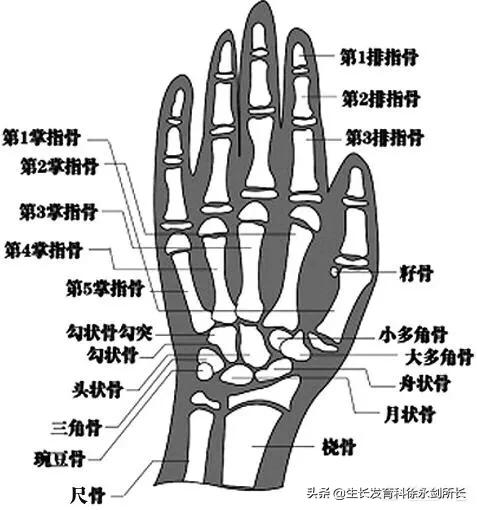 儿童手部骨骼发育图图片