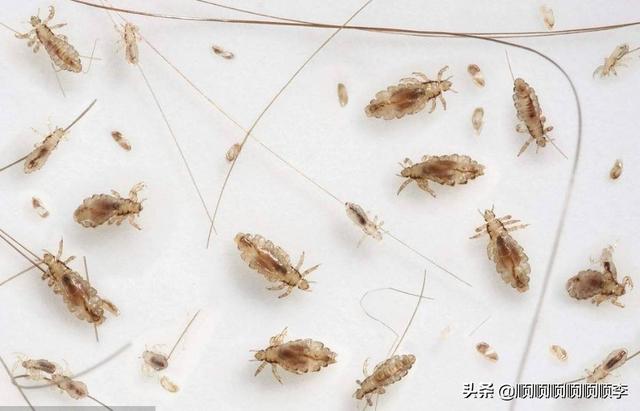 学校宿舍有虱子怎么弄,第1张