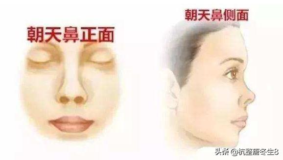 鼻孔朝天_鼻孔朝天是什么生肖