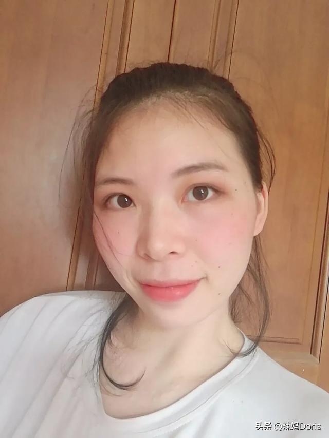 宝宝长湿疹怎么处理 （宝宝长湿疹怎么处理最好）