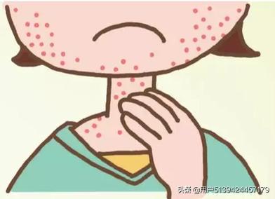 皮肤过敏体质怎么改善(图1)