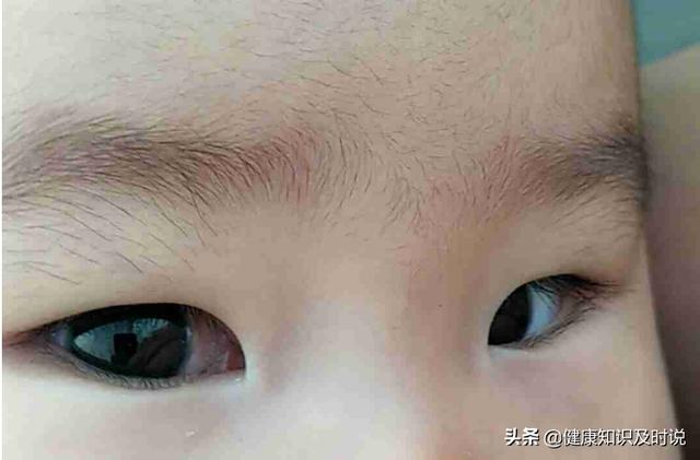 身体脾虚应该怎么调理(图4)