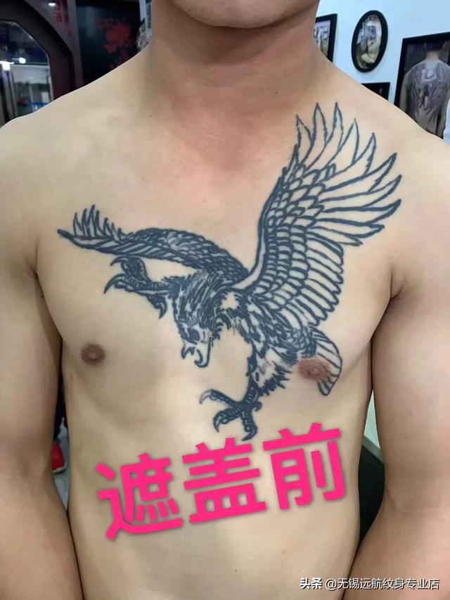 无锡市哪个医院洗纹身好