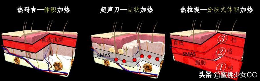 脸部怎么保养衰老慢(图20)