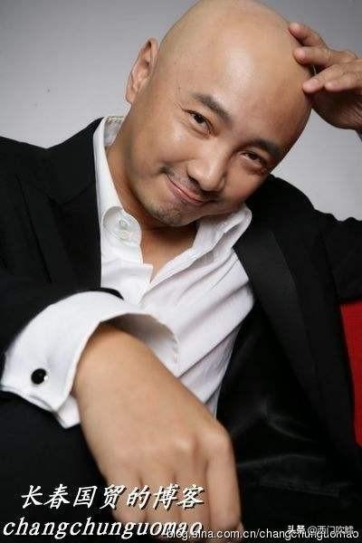 男地中海脱发怎么改善(图6)