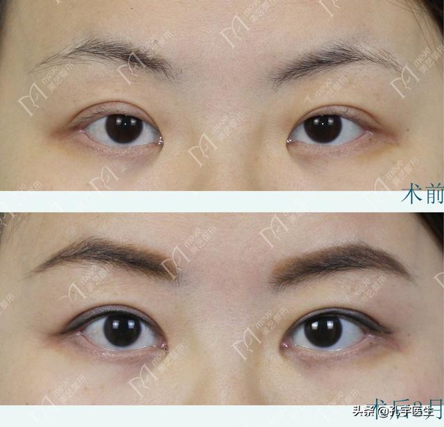 33720d1ed4af43a792b195c84beb68a1